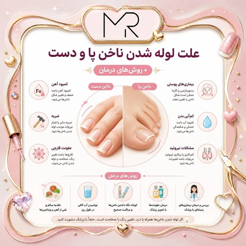 لوله شدن ناخن پا و دست